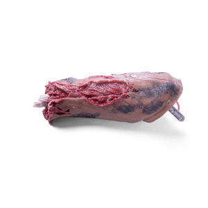 Laerdal Medical-Complete left leg - Amputation with Core-MedTech-3