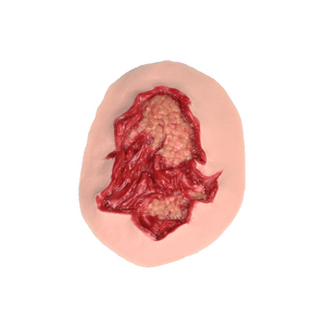 Laerdal Medical-Deep Abrasion - Laerdal-MedTech-1