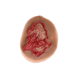 Laerdal Medical-Deep Abrasion - Laerdal-MedTech-3