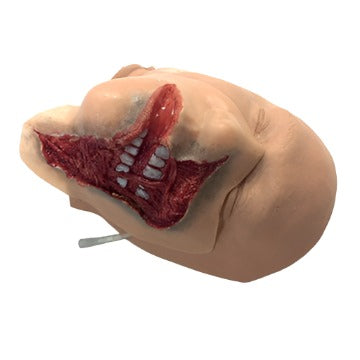 Nasco Healthcare-Exposed Denture Avulsion-MedTech-1