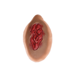 Laerdal Medical-Large Lesion - Laerdal-MedTech-3