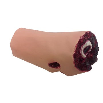 Nasco Healthcare-Leg Amputation-MedTech-1