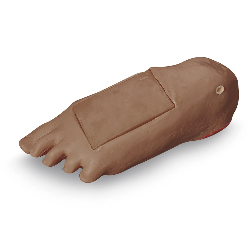 Nasco Healthcare-Life/form® GERi / KERi Optional Edema Foot with Deep Tissue Injury - Medium-MedTech-1