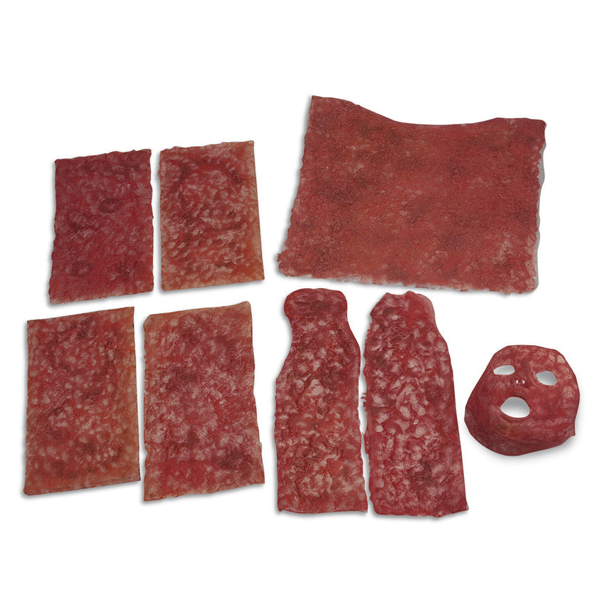Nasco Healthcare-Life/form® Simulated Burns Complete Set-MedTech-1