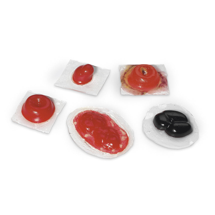 Nasco Healthcare-Life/form® Wound - Ostomies-MedTech-1