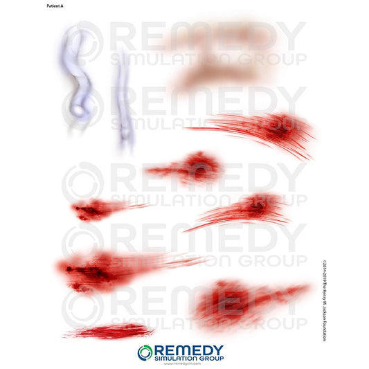 Wallcur-Moulage Tattoos - Patient A Scenario-MedTech-1