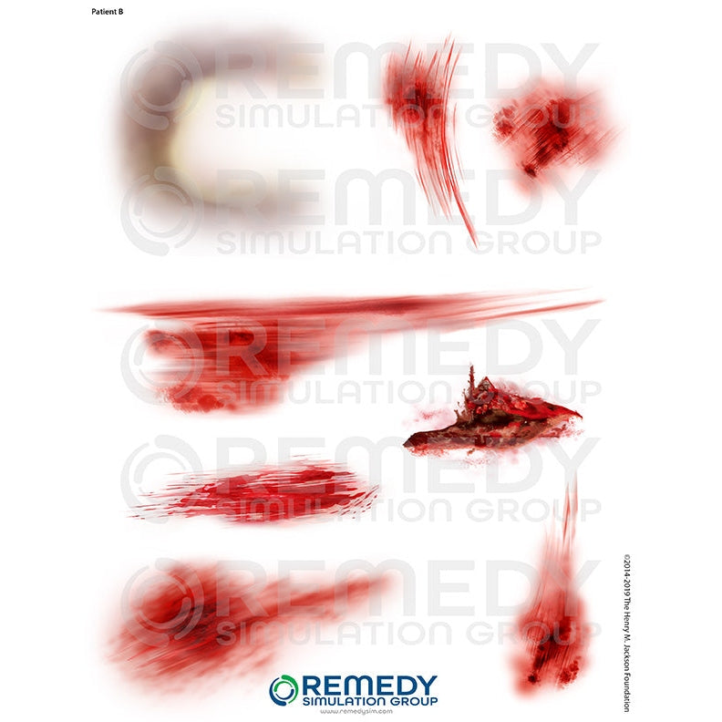 Wallcur-Moulage Tattoos - Patient B Scenario-MedTech-1