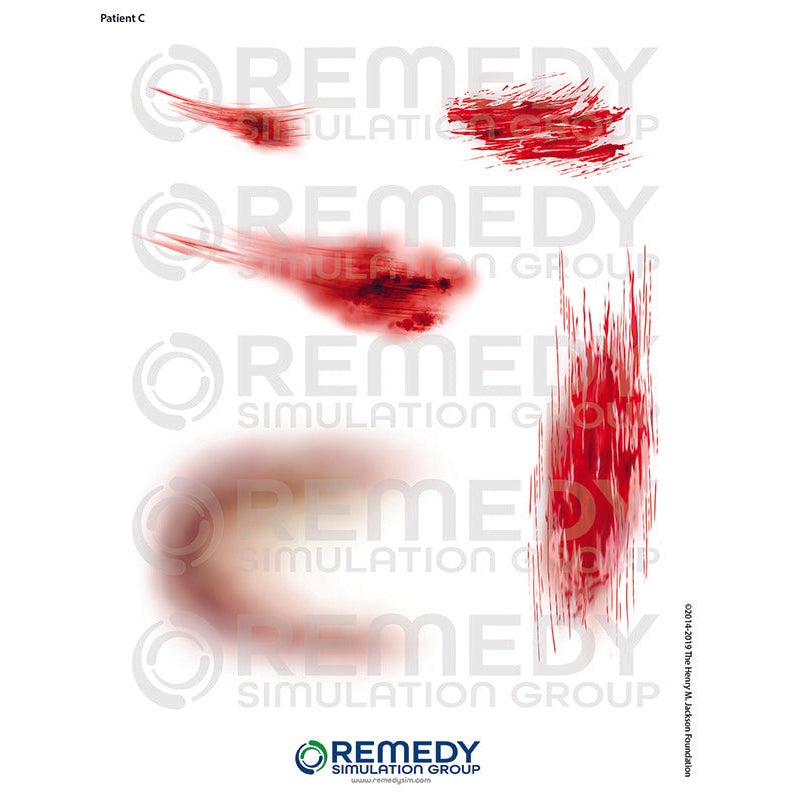 Wallcur-Moulage Tattoos - Patient C Scenario-MedTech-1