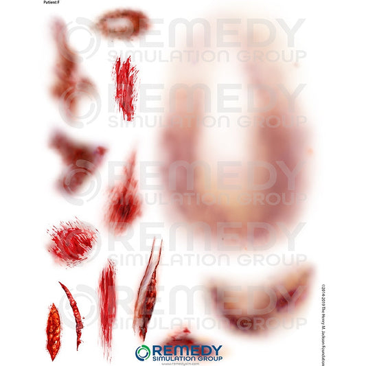 Wallcur-Moulage Tattoos - Patient F Scenario-MedTech-1