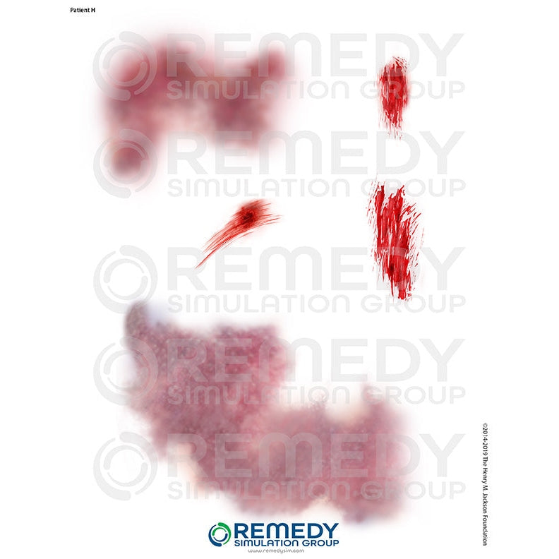 Wallcur-Moulage Tattoos - Patient H Scenario-MedTech-1