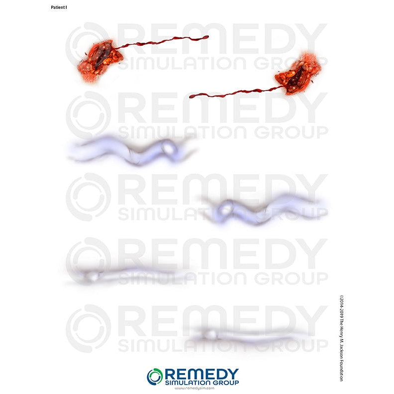 Wallcur-Moulage Tattoos - Patient I Scenario-MedTech-1