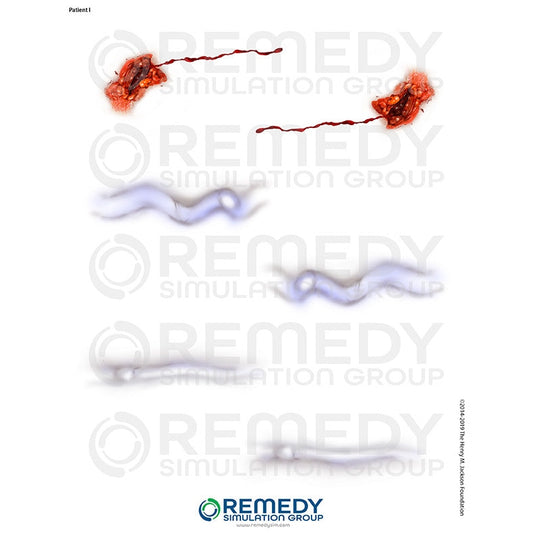 Wallcur-Moulage Tattoos - Patient I Scenario-MedTech-1