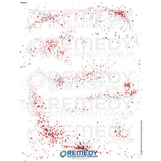 Wallcur-Moulage Tattoos - Patient J Scenario-MedTech-1