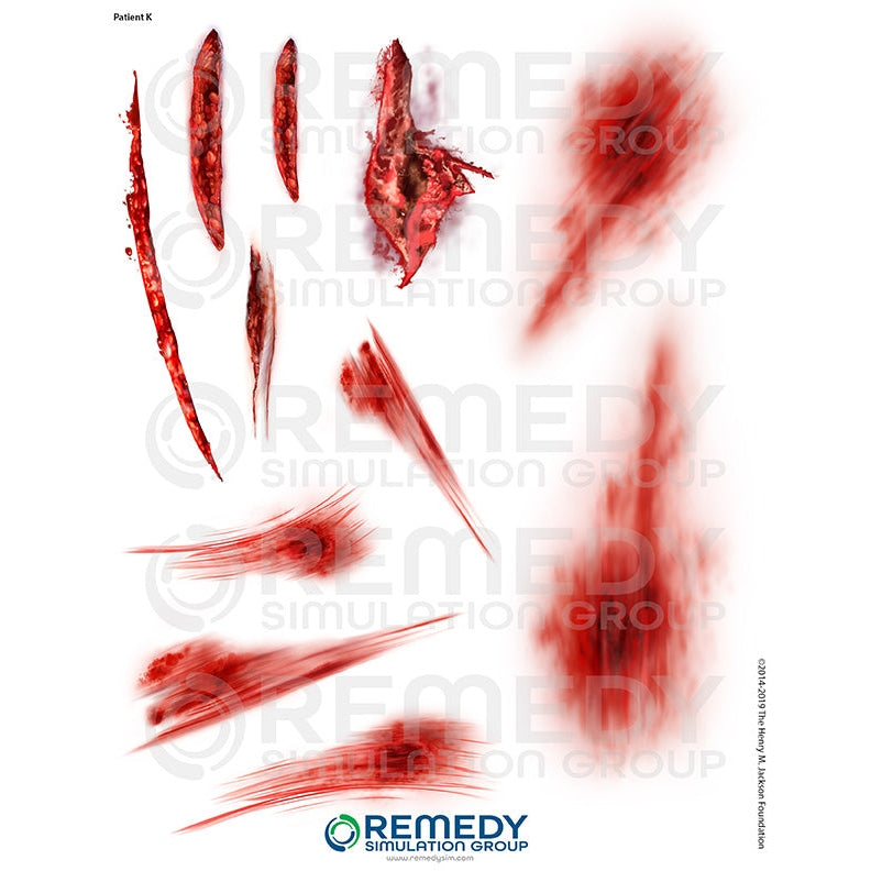 Wallcur-Moulage Tattoos - Patient K Scenario-MedTech-1