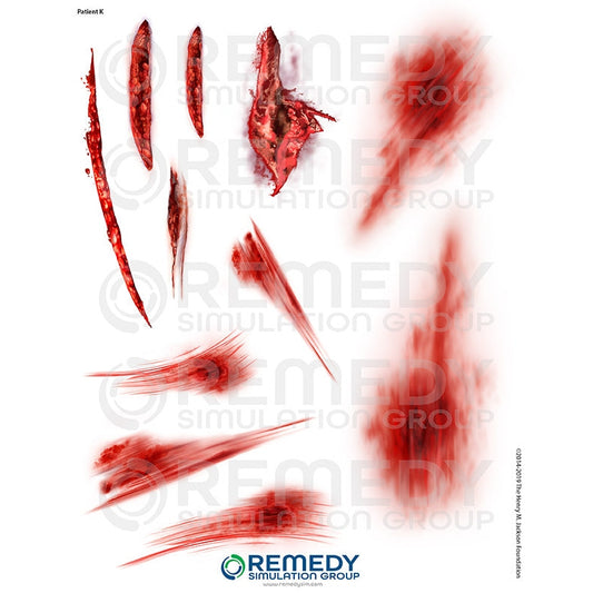 Wallcur-Moulage Tattoos - Patient K Scenario-MedTech-1