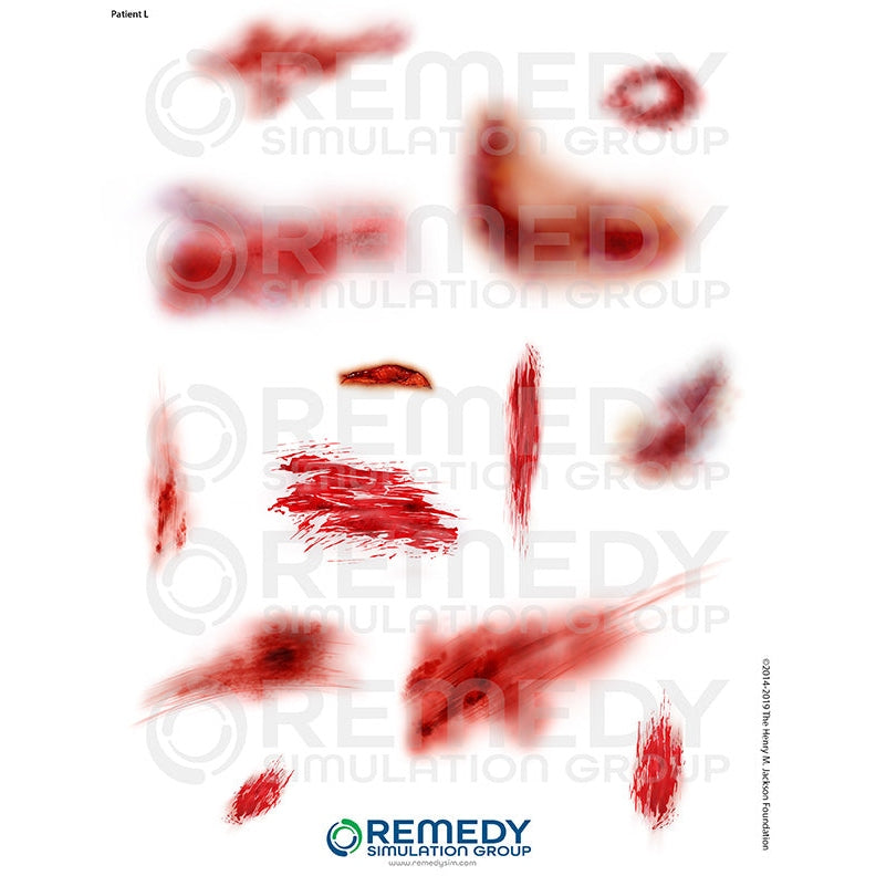 Wallcur-Moulage Tattoos - Patient L Scenario-MedTech-1