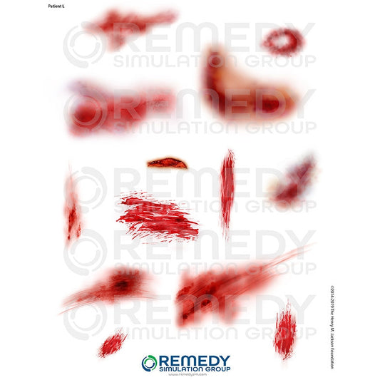 Wallcur-Moulage Tattoos - Patient L Scenario-MedTech-1