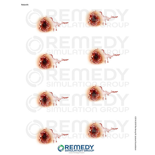 Wallcur-Moulage Tattoos - Patient N Scenario-MedTech-1