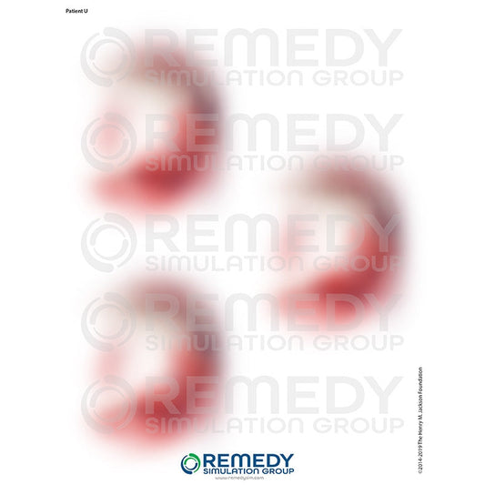 Wallcur-Moulage Tattoos - Patient U Scenario-MedTech-1