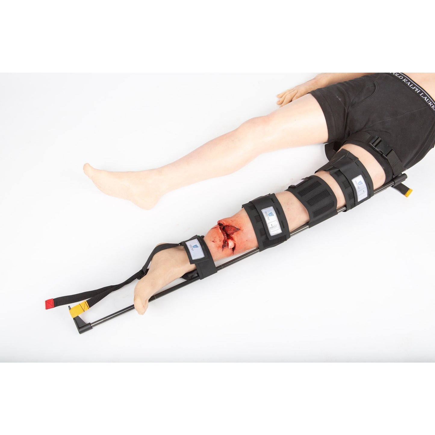 Safeguard Medical-Prometheus Traction Splint-MedTech-3