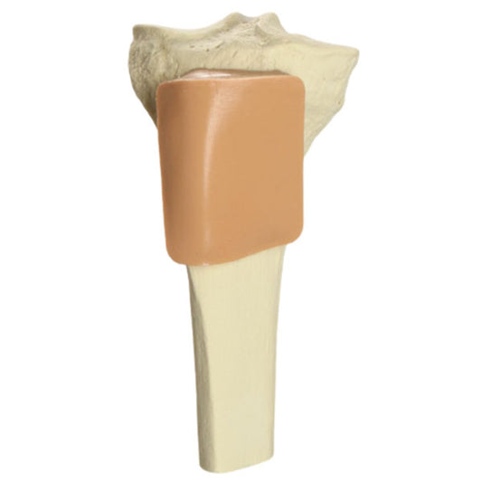 Sam Medical-SAM IO Sawbone-MedTech-1