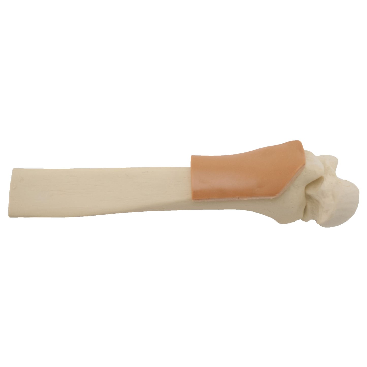 Sam Medical-SAM IO Sawbone-MedTech-4