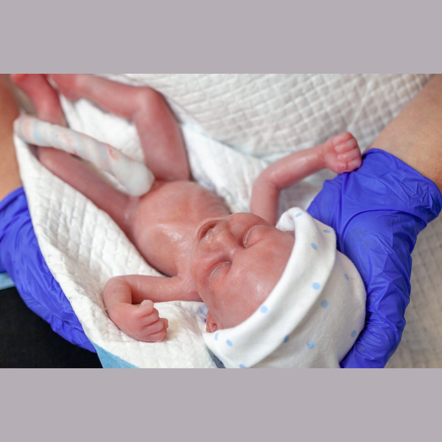 Safeguard Medical-SimBODIES Advanced 28-Week Pre-Term Manikin-MedTech-4