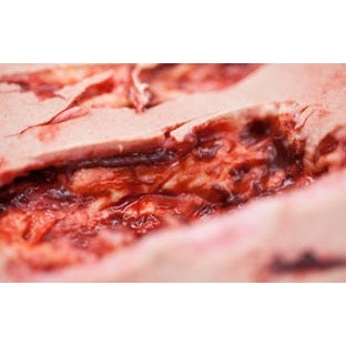 Safeguard Medical-SimBODIES Nursing & Wound Care Simulation Sleeves Kit-MedTech-4