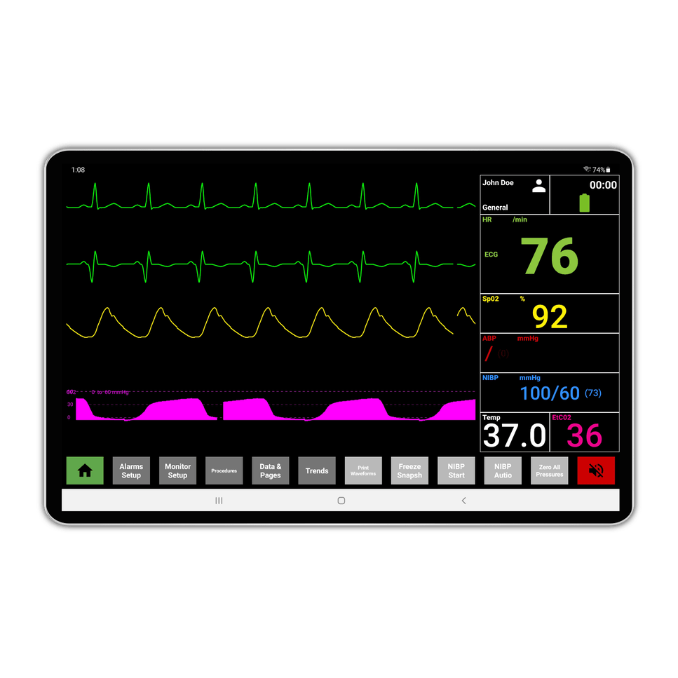 SimVS-SimVS Nucleus Plus-MedTech-4