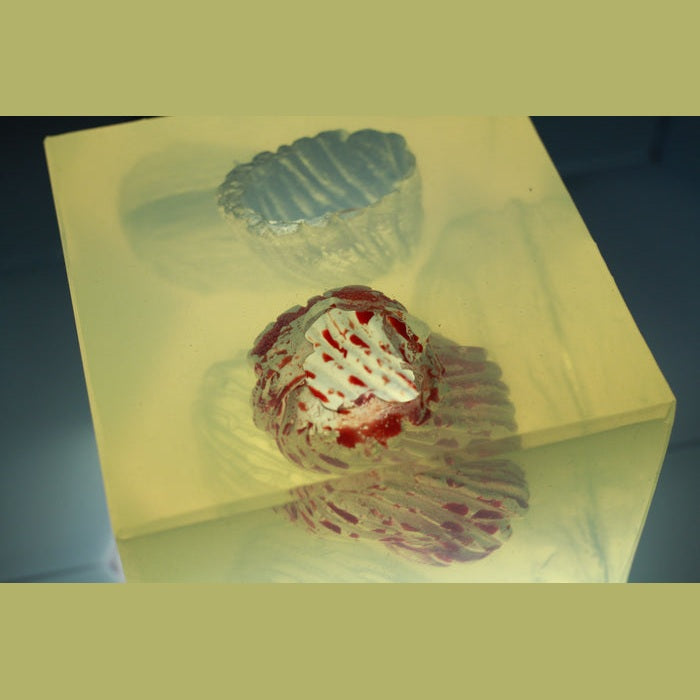 Phokus Research Group-Wound CLUB™ PRO Gen2-MedTech-13