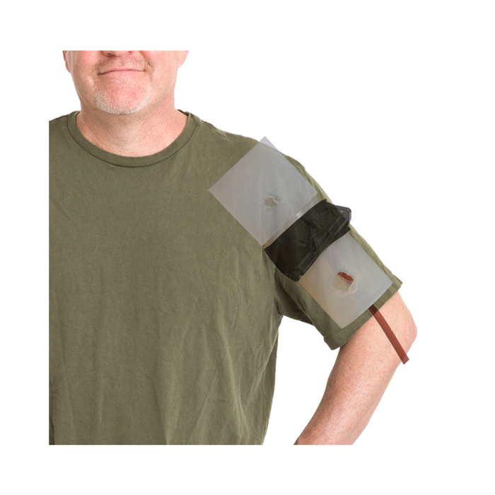 Phokus Research Group-Wound CLUB™ PRO Gen2-MedTech-6