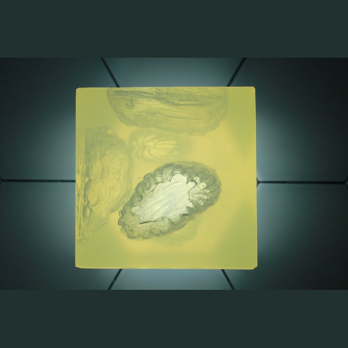 Phokus Research Group-Wound CLUB™ PRO Gen2-MedTech-7