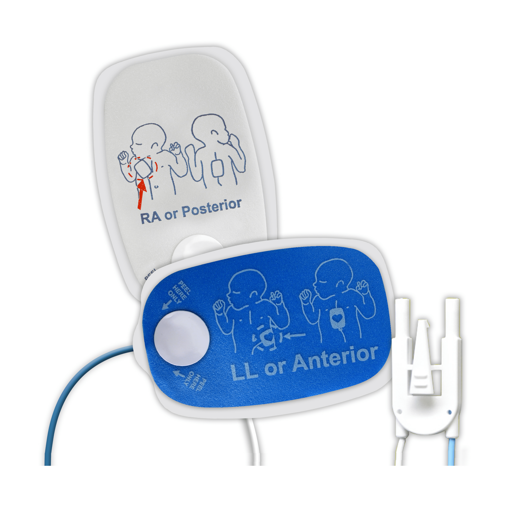 ZOLL-Heart Sync® ZOLL® Multi-Function Defibrillator Pads, Leads In, Pediatric 1 Pair-MedTech-2