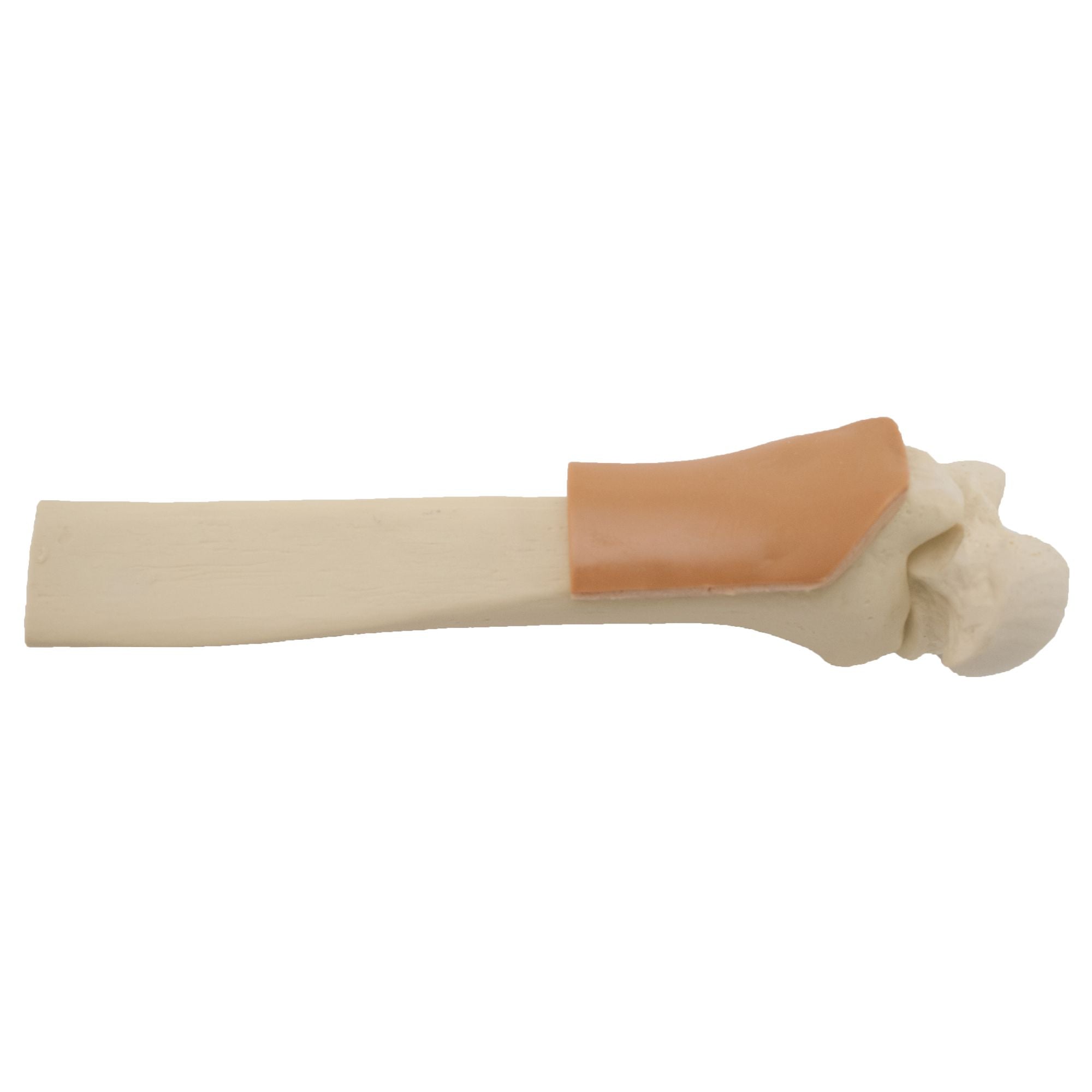  Sam Medical-SAM IO Sawbone-MedTech-4