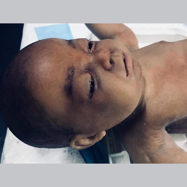 Safeguard Medical-SimBODIES Advanced Infant Manikin-MedTech-12