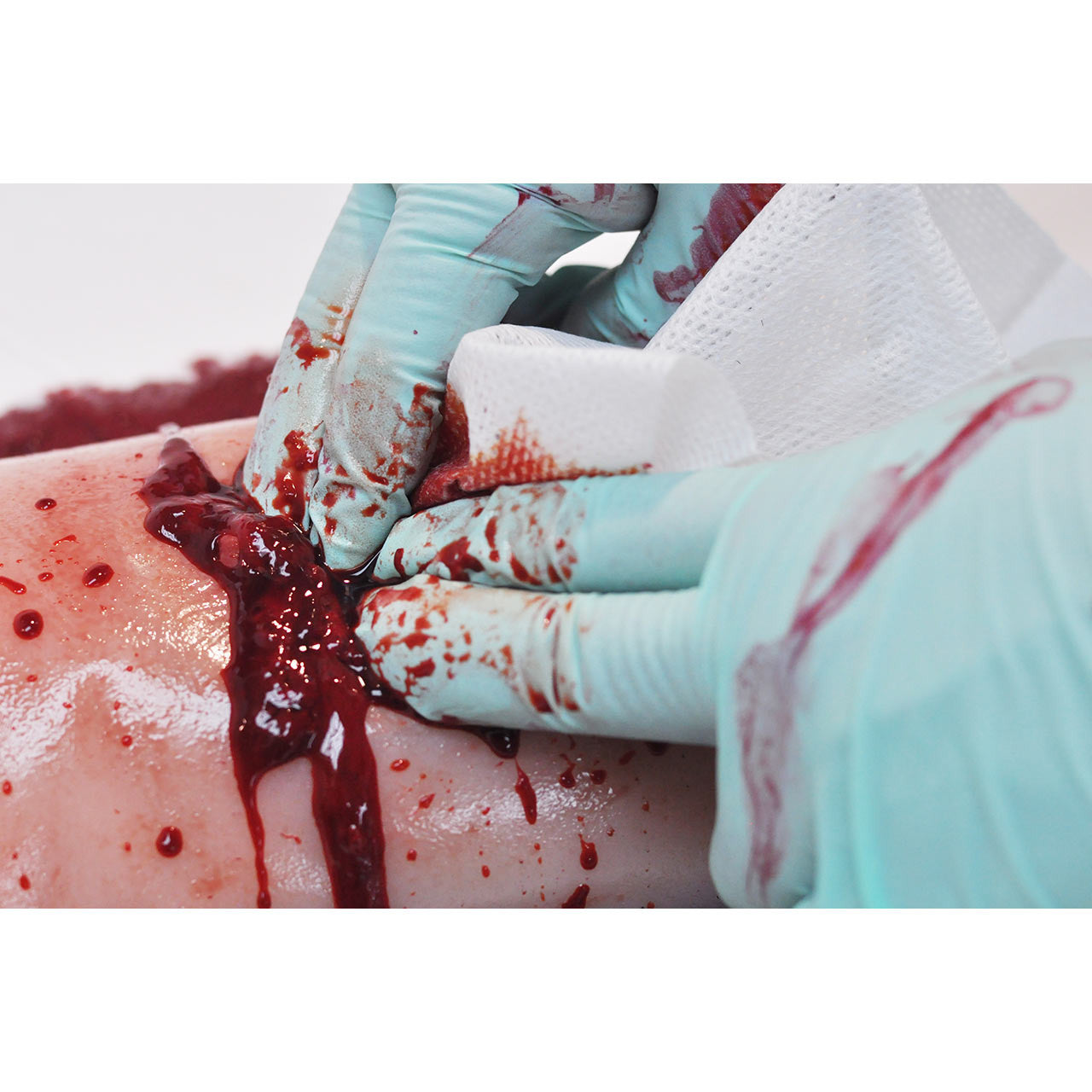  TrueClot®-TrueClot Clotting Solution, 500mL-MedTech-5