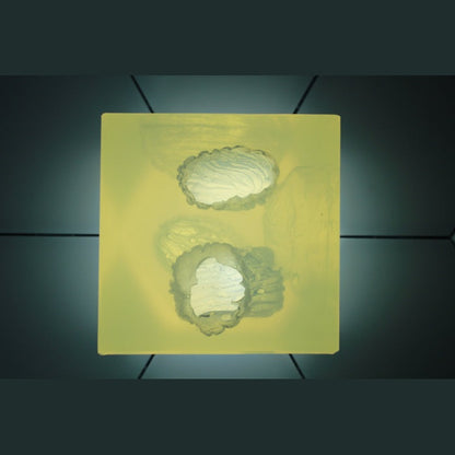 Phokus Research Group-Wound CLUB™ PRO Gen2-MedTech-9